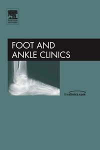 Cover for Complex Salvage of Ankle and Hindfoot Deformity, An Issue of Foot and Ankle Clinics (Volume 12-1)