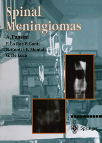 Cover for Spinal Meningiomas